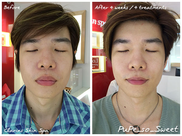  photo ClarinsBeforeAfter.png