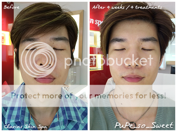  photo ClarinsBeforeAfter.png