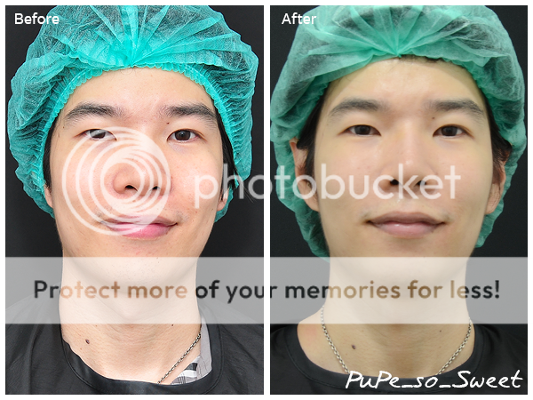  photo PP Before After Front.png